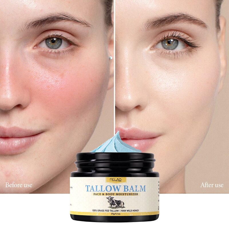 Beef Tallow Balm Manufacturer - Custom 3 Ingredient Grass Fed Handmade Honey Whipped Balm