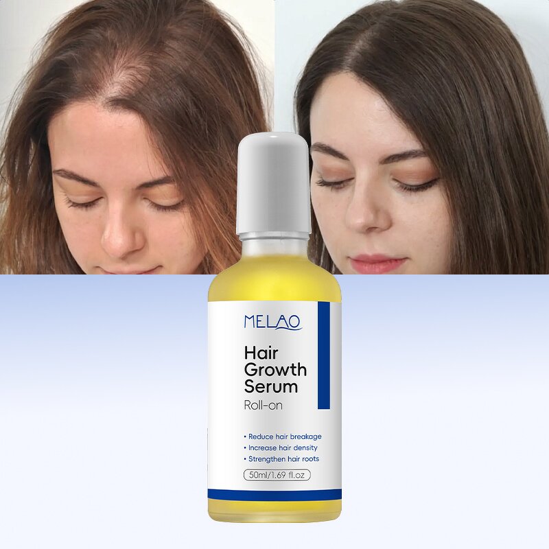 Hair Growth Serum Manufacturer - Private Label Roll on Hydrating Healthy Rosemary for Scalp