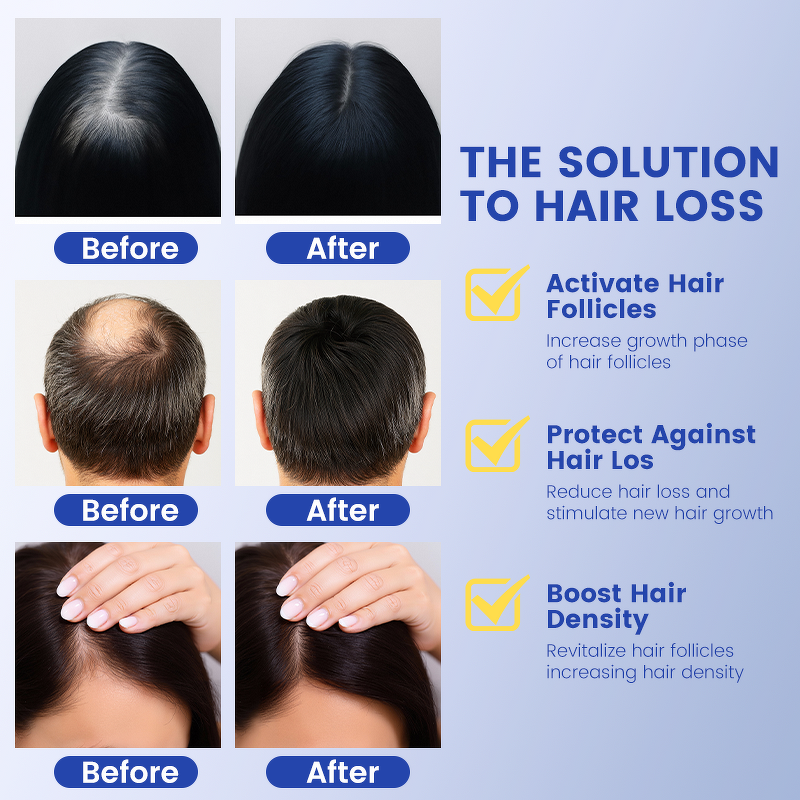 Hair Serum Manufacturer - Herbal Scalp Soothing Strengthen Roots Damaged Hair Repair for Loss