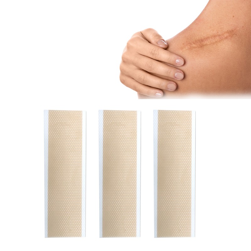 Scar Removal Strips Manufacturer - Professional Prevention Solution