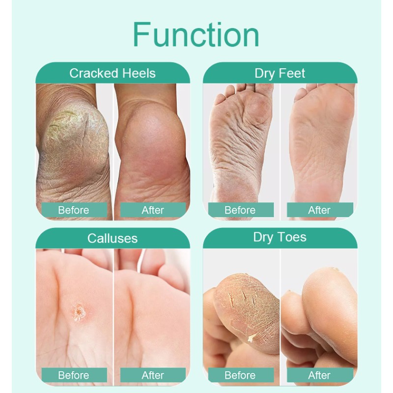 Korea Foot Peeling Mask Factory - Exfoliating Sock Skin Care