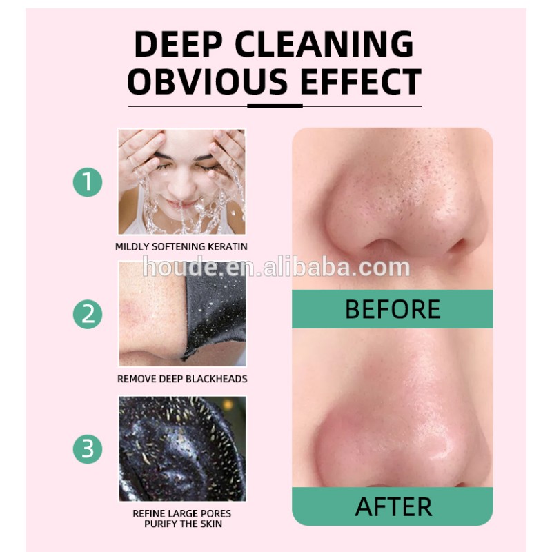 Pore Purifying Strips Supplier - Plants Deep Mask Wholesale