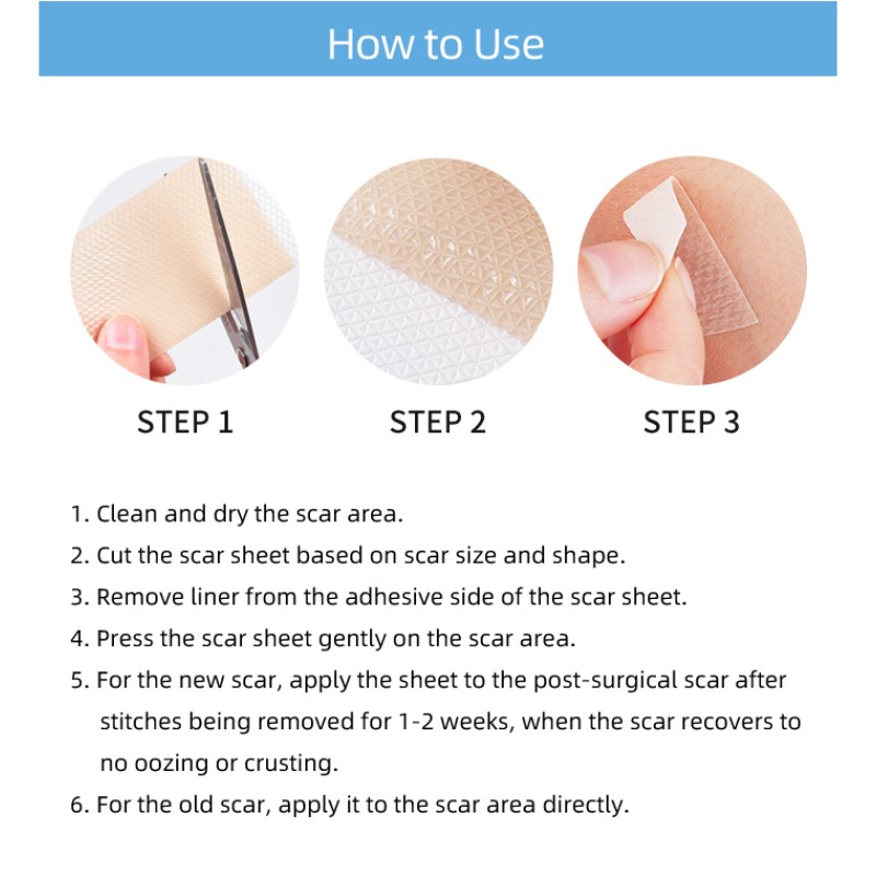 Silicone Scar Sheets Manufacturer - Reusable C-Section Skincare