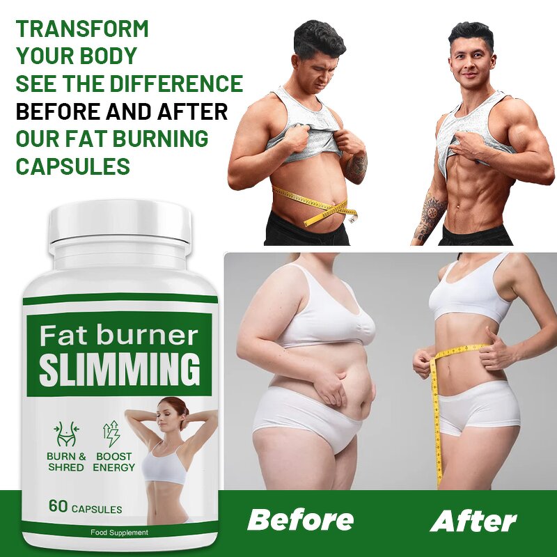 Weight Loss Capsule Manufacturer - Private Label Apple Cider Vinegar Detox Appetite Suppressant Fat Burn