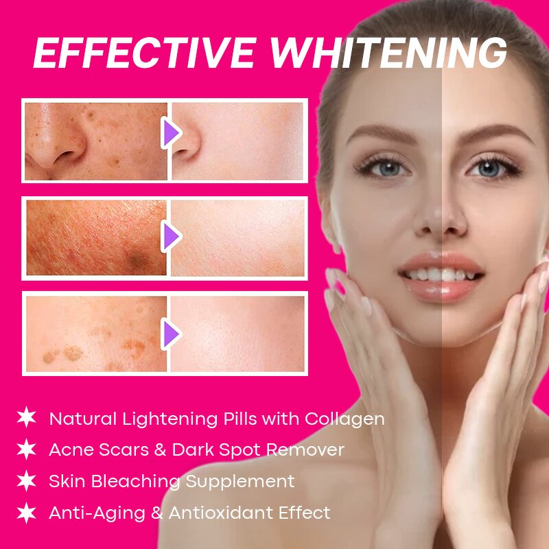 Skin Whitening Supplement Manufacturer - Customized Vegan Plant Based Natural Skin Lightening Pills