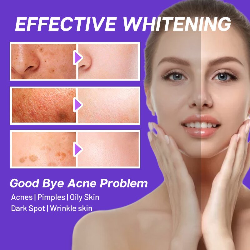 Skin Whitening Supplement Manufacturer - Lightening Pills Collagen Dark Spot Remover Bleaching