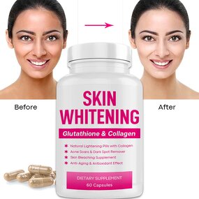 Skin Whitening Supplement Manufacturer - Customized Vegan Plant Based Natural Skin Lightening Pills