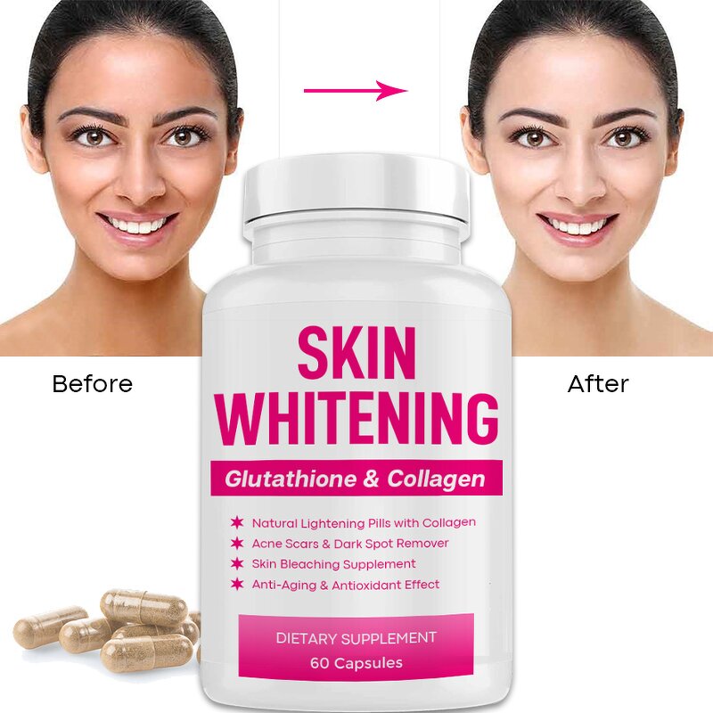 Skin Whitening Supplement Manufacturer - Customized Vegan Plant Based Natural Skin Lightening Pills