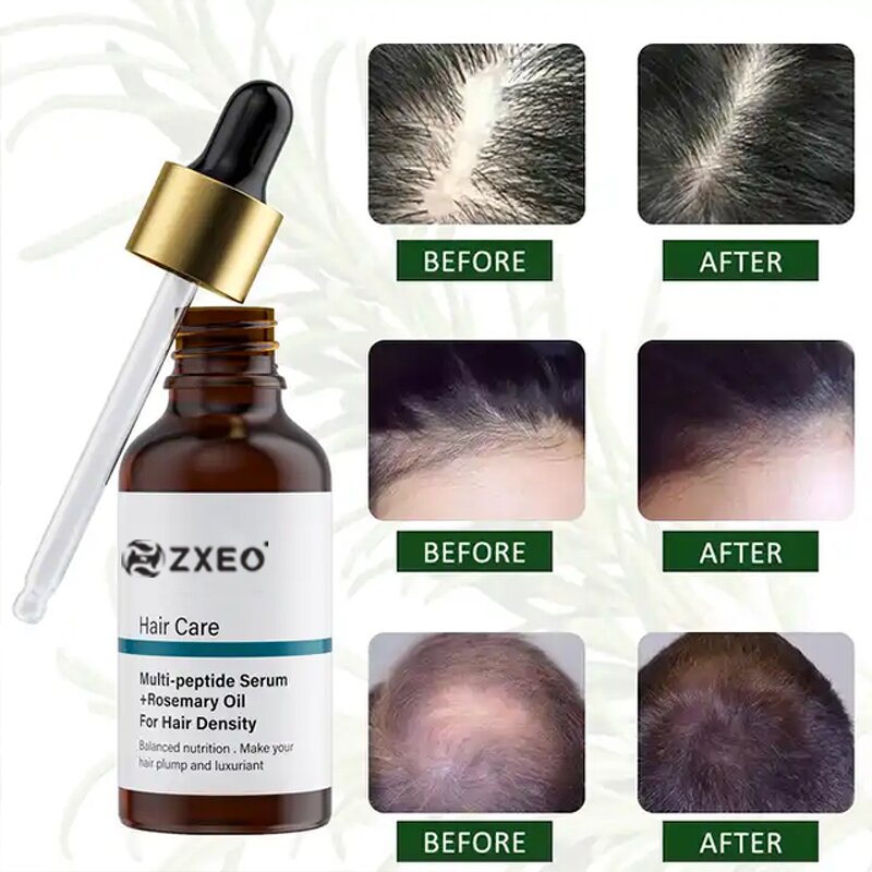 Rosemary Hair Oil - New Product for Thin Skin Healthy Scalp Hair Growth