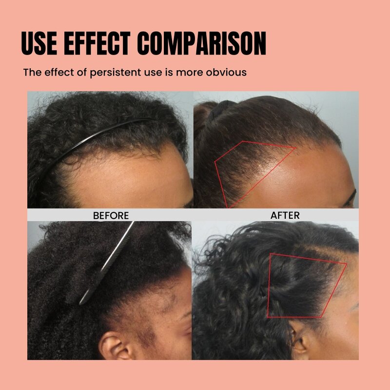 Chebe Powder & Karkar Oil Manufacturer - Wholesale Authentic for Scalp Health Damaged Hair 60ml