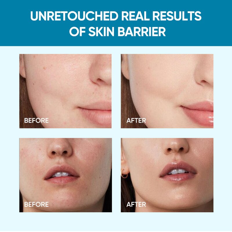 Moisturizer Cream Manufacturer - Ceramide Hydrating Gel - Hyaluronic Acid Collagen Skin Barrier Repair