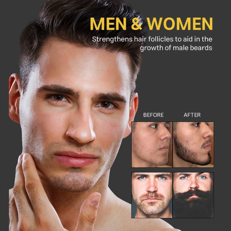 Beard Growth Serum Manufacturer - Small Batch Customization - Hair Care Treatment Private Label