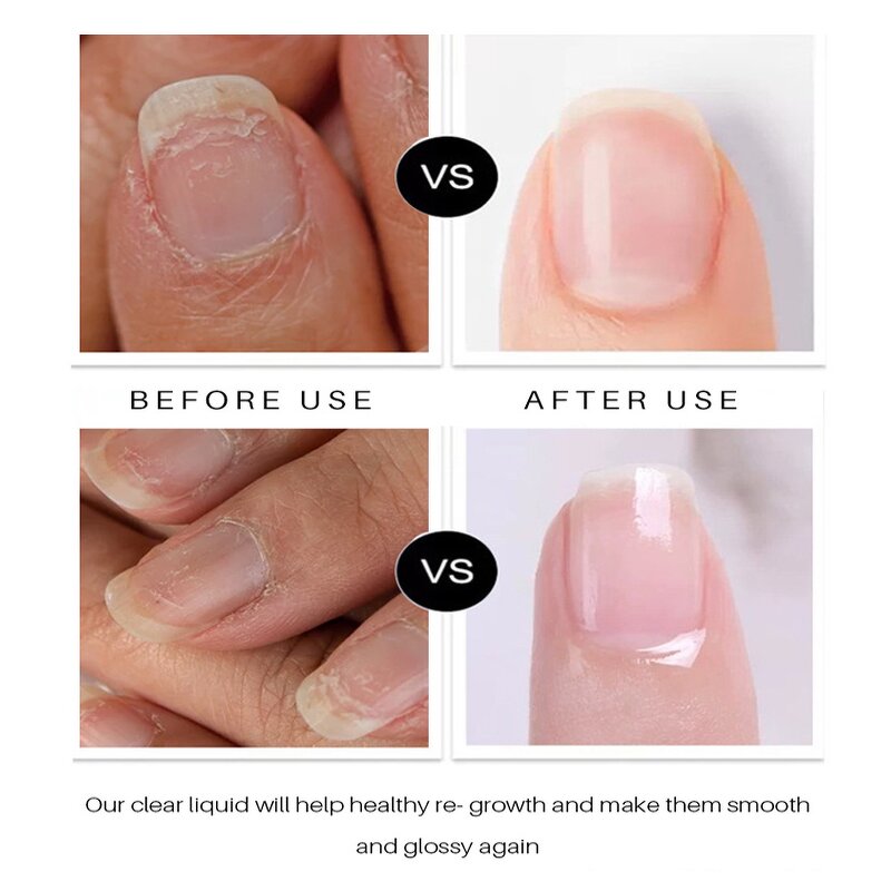 Nail Care Pen Manufacturer - Castor Oil Aloe Vera - Strengthening Growth Weak Nails Private Label