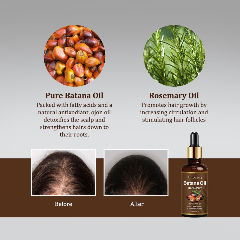 Hair Growth Oil Manufacturer - Natural Organic Batana Oil - Scalp Massage Nourishing Private Label OEM