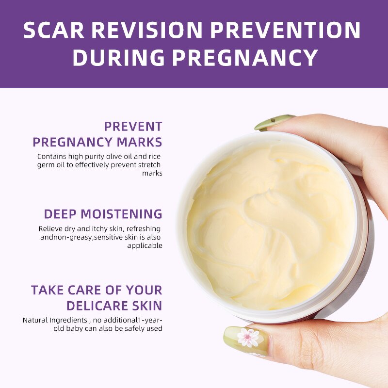 Stretch Mark Cream Manufacturer - Strong Scar Removal - Pregnancy Skin Repair Treatment OEM Private Label