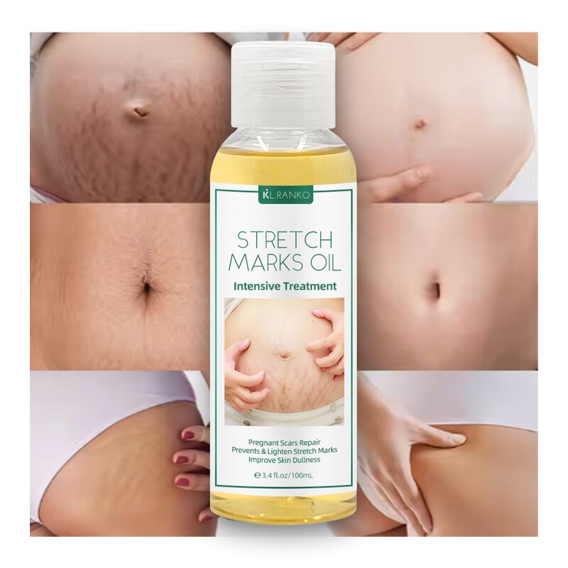 Stretch Mark Oil Manufacturer - Postpartum Repair Massage Oil - Scar Removal Body Moisturizing Treatment