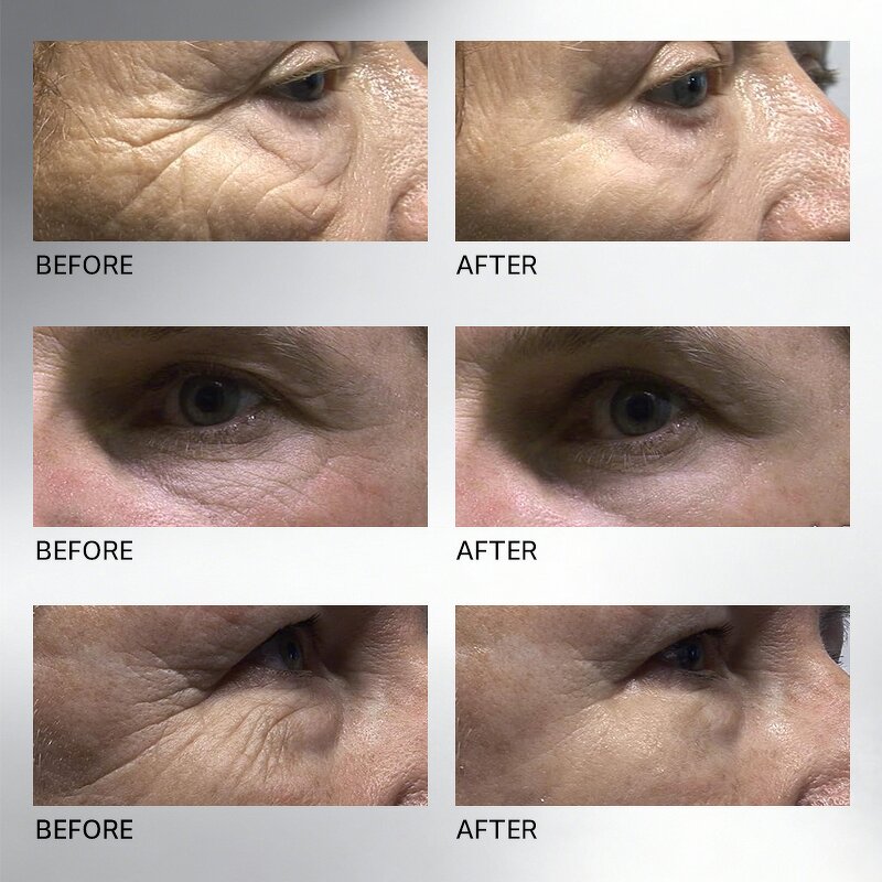 Firming Cream Manufacturer - Peptide Complex Hyaluronic Acid - Wrinkle Reduction Firming Skin Private Label