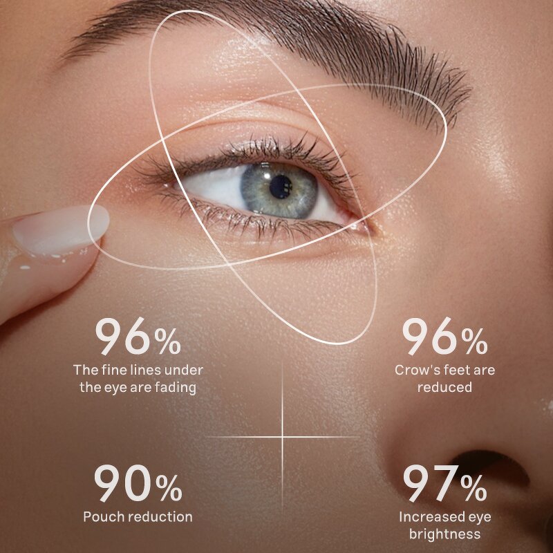 Under Eye Oil Manufacturer - Frankincense Castor Roller - Bag Wrinkle Crow's Feet Fine Lines Private Label