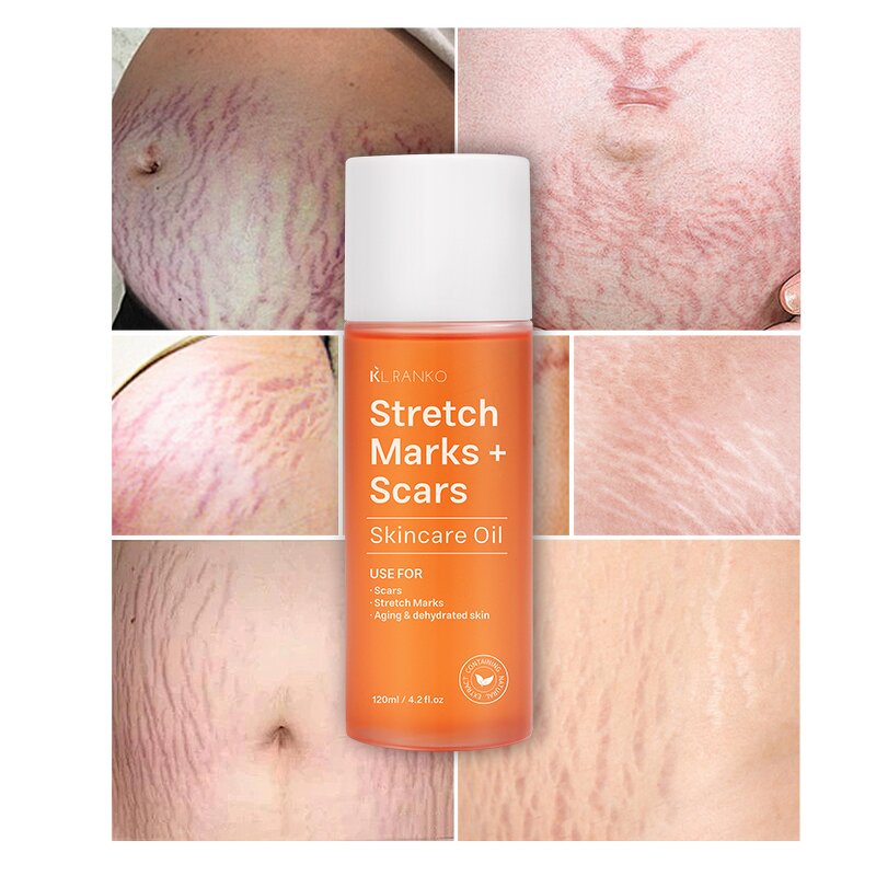 Stretch Mark Oil Manufacturer - 100% Natural Scar Removal - Safe Effective Stretch Mark Treatment Private Label