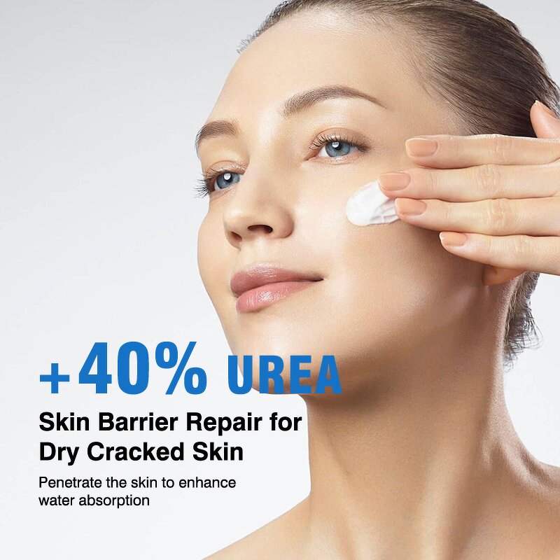 Foot Cream Manufacturer - Anti-Cracking Urea 40% - Dry Cracked Skin Callus Remover Hand Foot Care OEM