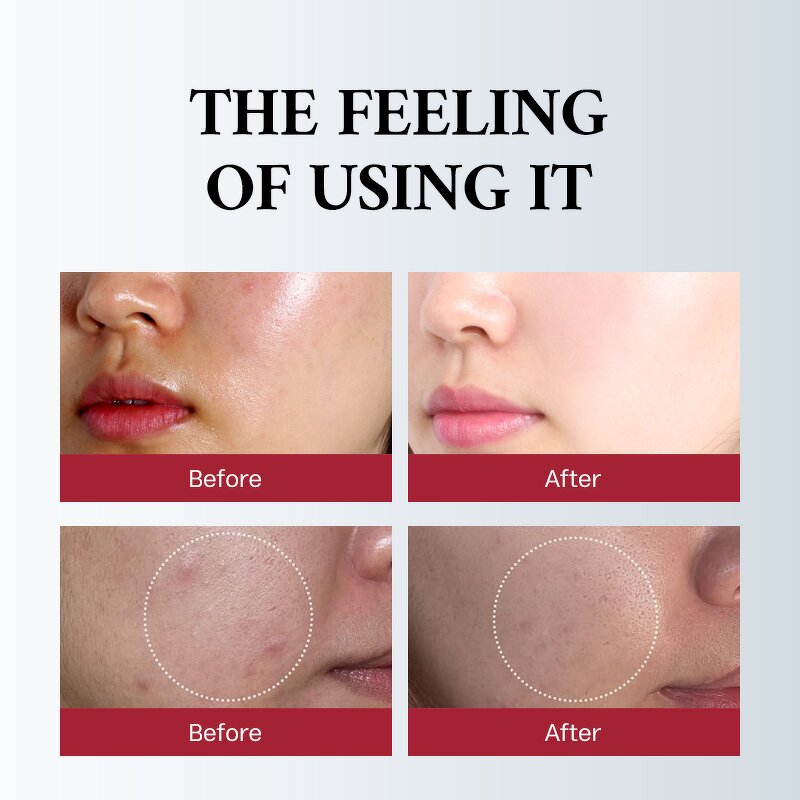 Skincare Set Manufacturer - Glutathione Whitening 5 Pcs - Pigmentation Correction Hydrating Niacinamide Set