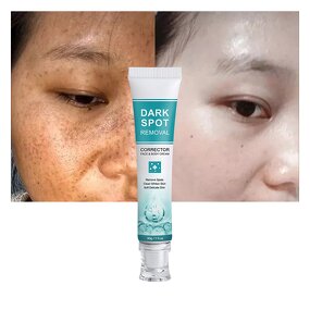 Dark Spot Removal Cream Manufacturer - Kojic Acid Dark Spot Corrector - Freckle Melasma Acne Clear Skin