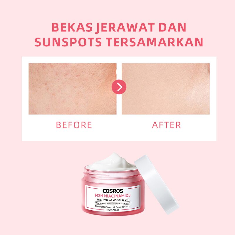 Brightening Gel Cream Manufacturer - Ceramide MSH Niacinamide - Alpha Arbutin Tranexamic Acid Even Skin Tone