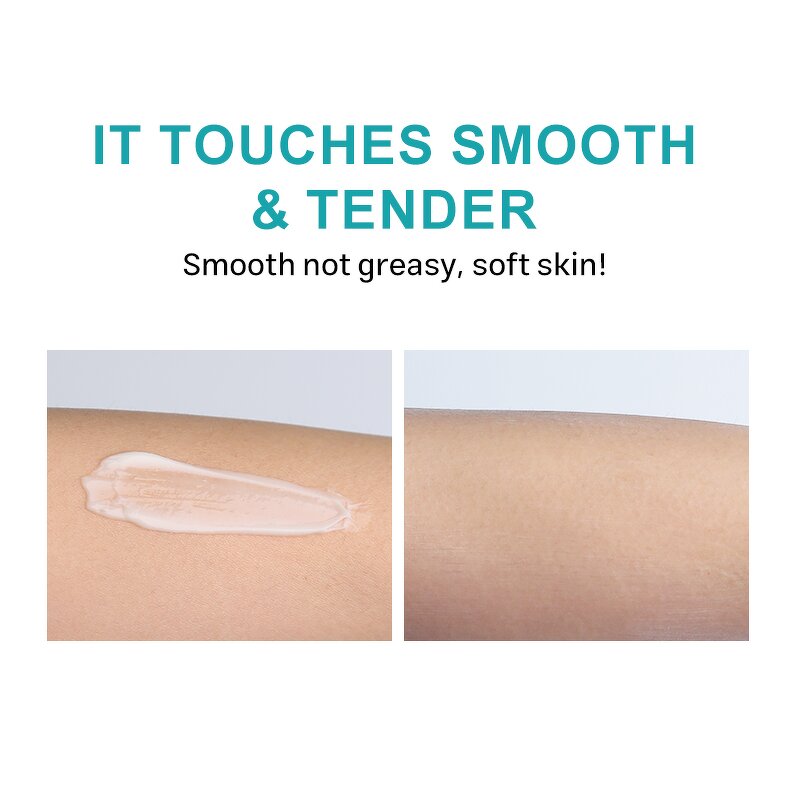 Dark Spot Removal Cream Manufacturer - Kojic Acid Dark Spot Corrector - Freckle Melasma Acne Clear Skin