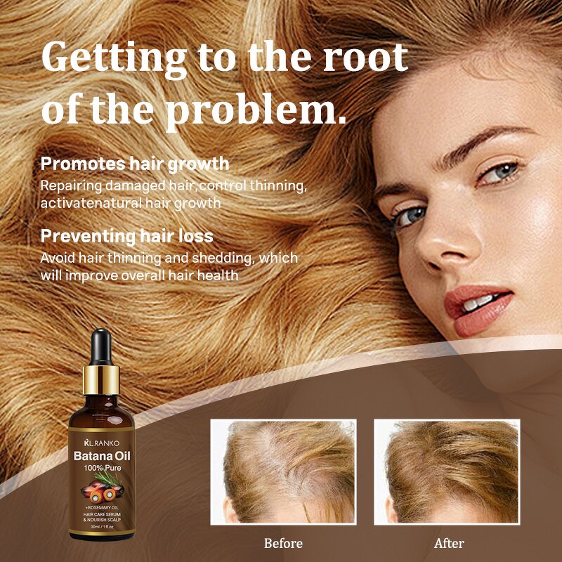 Hair Growth Oil Manufacturer - Natural Organic Batana Oil - Scalp Massage Nourishing Private Label OEM