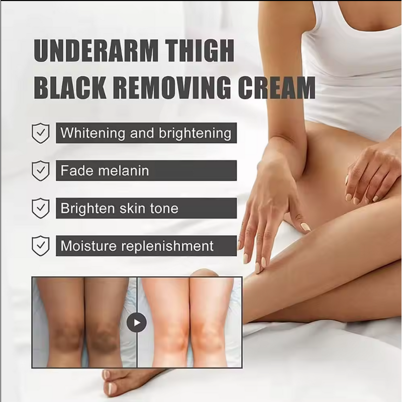 Underarm Whitening Cream Manufacturer - Private Label Body Skin Dark Spot Remover Private Part Lightening Lotion