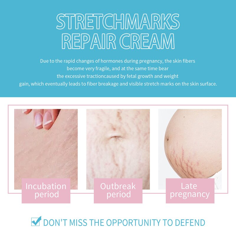 Scar Removal Cream Manufacturer - Collagen Hyaluronic Acid Body Scar Stretch Mark Repair Smoothing Firming Anti-Wrinkle