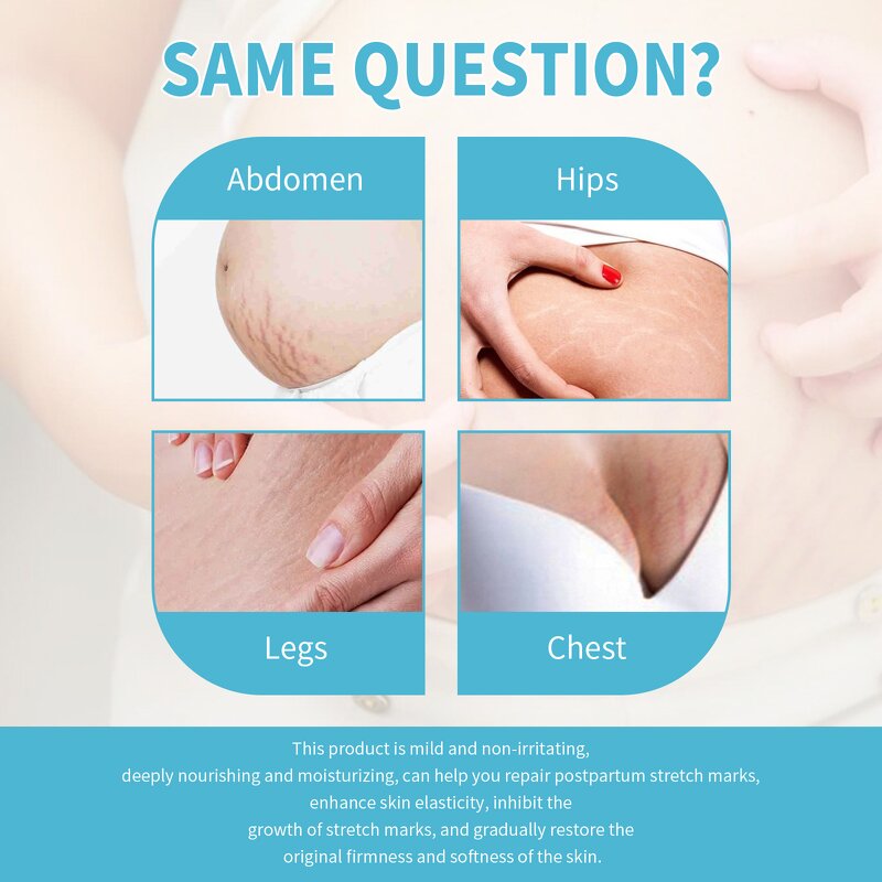 Scar Removal Cream Manufacturer - Collagen Hyaluronic Acid Body Scar Stretch Mark Repair Smoothing Firming Anti-Wrinkle