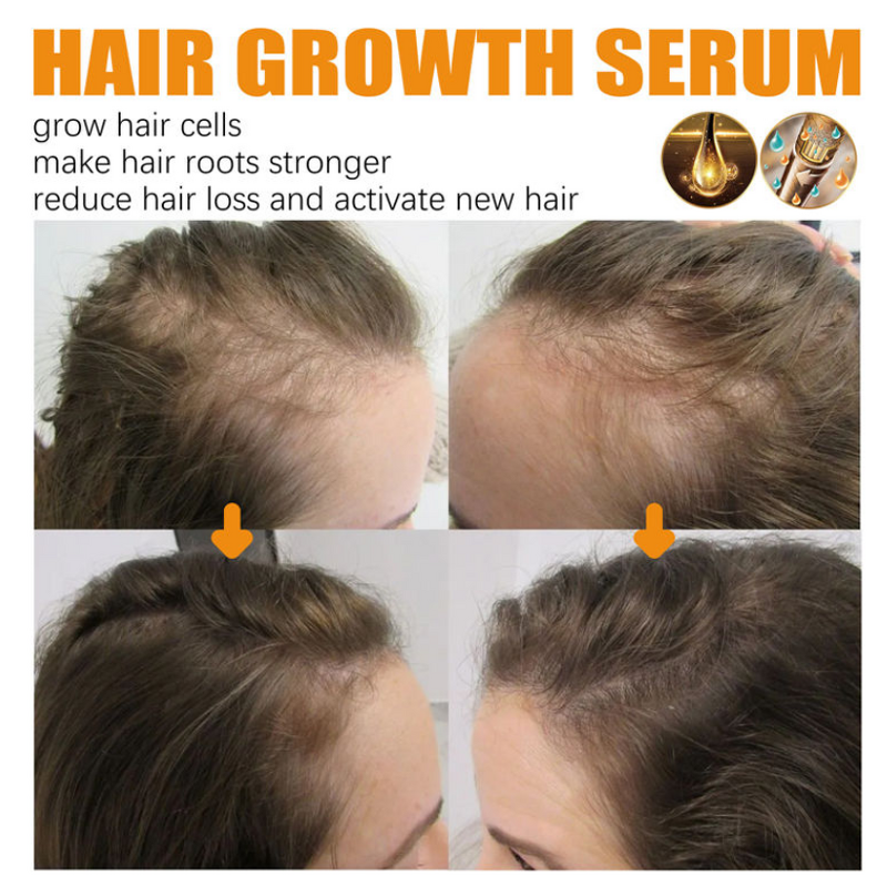 Hair Oil Manufacturer - South Moon Herbal Moisturizes Protect Black Hair Loss Prevention Smooth Shine Repair Formula