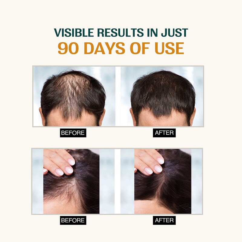 Hair Growth Serum Manufacturer - Private Label Regrowth Oil Treatment Scalp Advanced Fast Hair Growth Formula