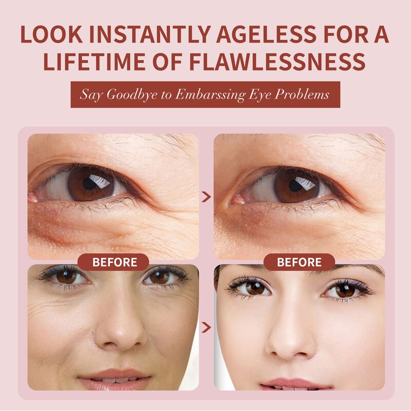 Eye Cream Manufacturer - Eye Bags Rapidly Reducing Wrinkles Fine Lines Instant Firming Dark Circle Formula