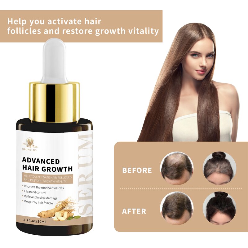 Hair Treatment Oil Manufacturer - Organic Scalp Care Ginseng Ginger Repair Regrowth Anti-Hair Loss Serum