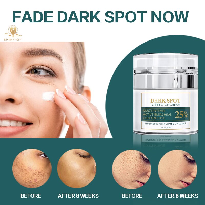 Face Cream Manufacturer - Anti Pigmentation Aging Brightening Lightening Melasma Removal Dark Spot Corrector