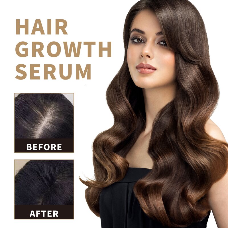 Hair Growth Oil Manufacturer - 100% Natural Angelica Ginseng Ginger Repair Regrowth Anti-Hair Loss Treatment