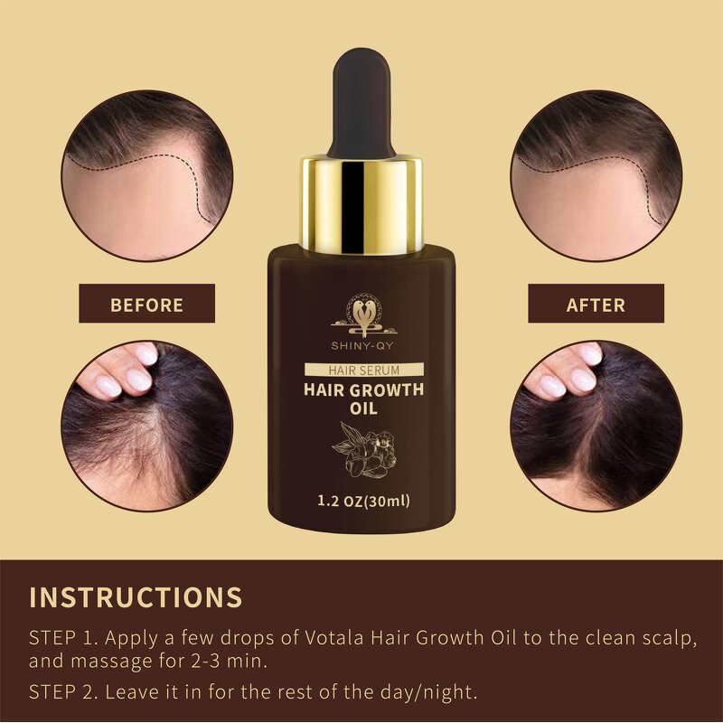 Hair Growth Serum Manufacturer - Custom Logo Biotin Scalp Care Anti-Hair Loss Ginseng Regrowth Treatment Oil