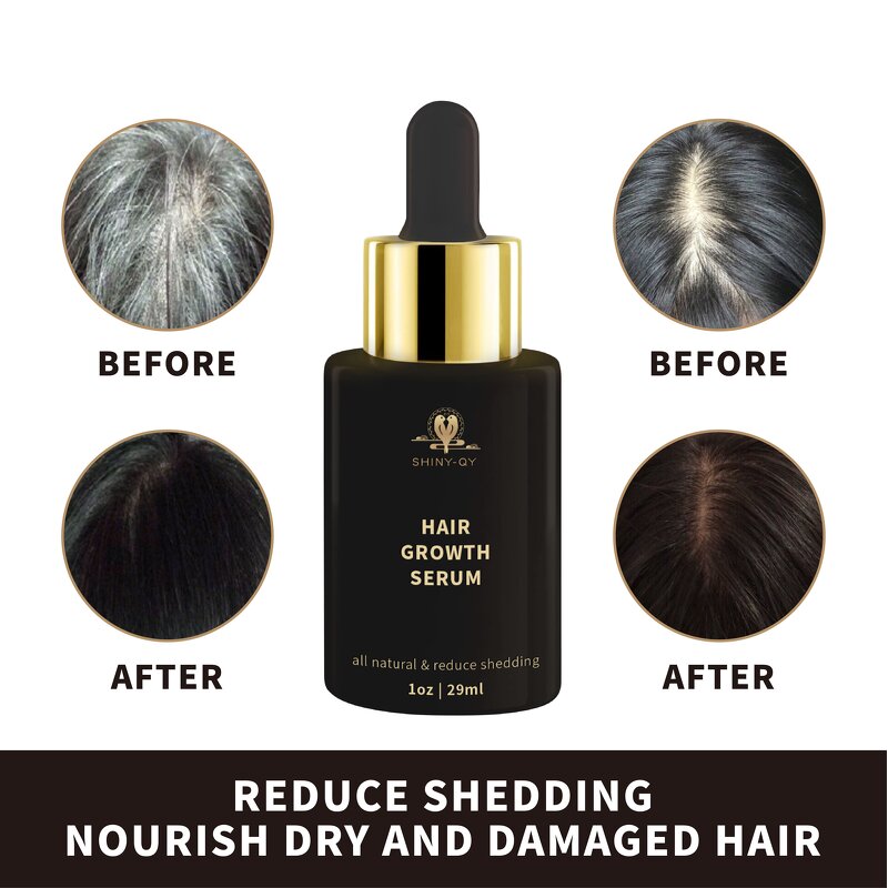 Hair Growth Oil Manufacturer - 100% Natural Angelica Ginseng Ginger Repair Regrowth Anti-Hair Loss Treatment