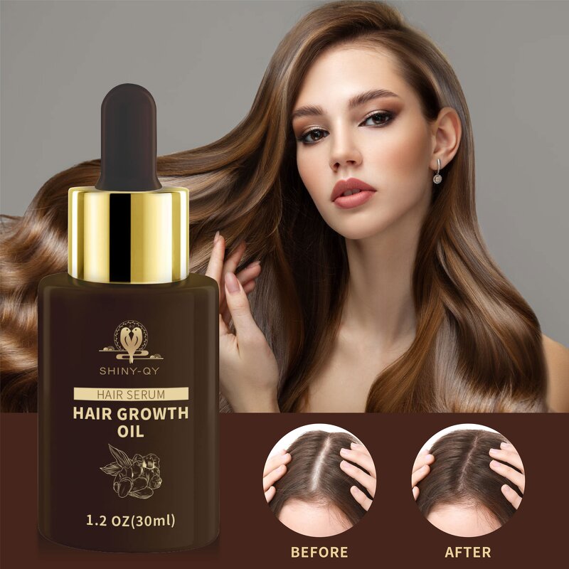 Hair Growth Serum Manufacturer - Custom Logo Biotin Scalp Care Anti-Hair Loss Ginseng Regrowth Treatment Oil