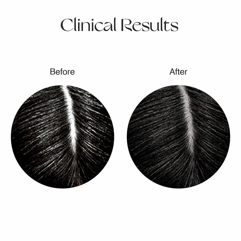 Herbal Hair Serum Manufacturer - Private Label Regrowth Oil Rice Water Treatment Scalp Herbal Growth Formula