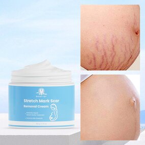 Stretch Mark Cream Manufacturer - Private Label Natural Non-Irritating Fast Acting Smooth Skin Repair Formula