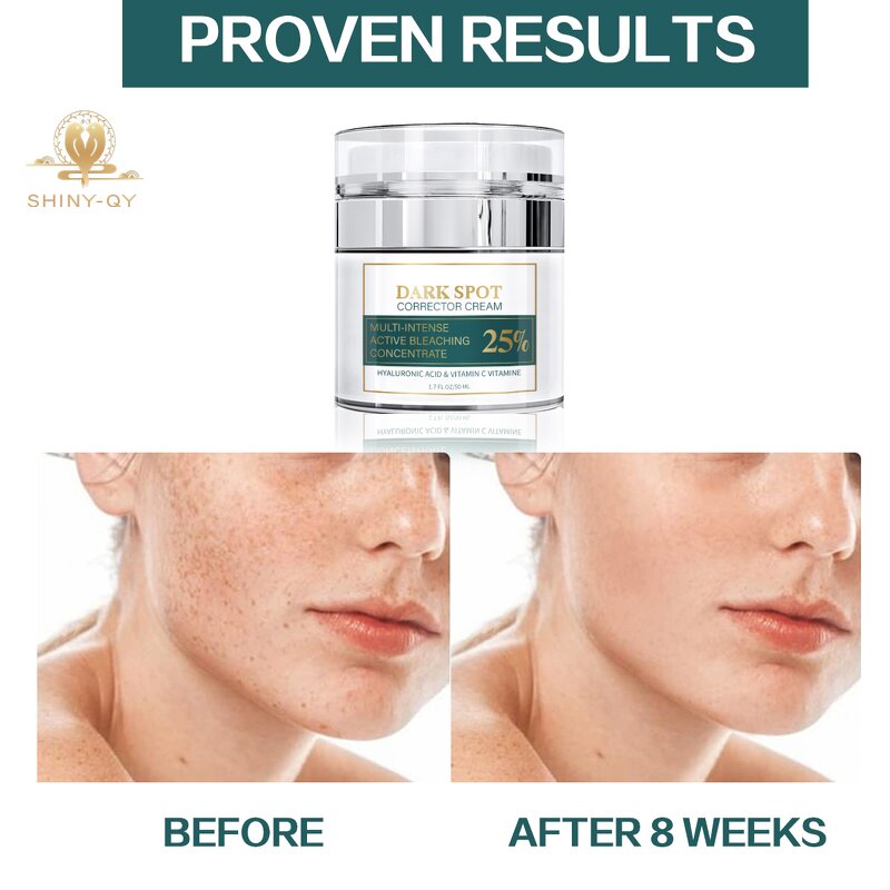 Face Cream Manufacturer - Anti Pigmentation Aging Brightening Lightening Melasma Removal Dark Spot Corrector