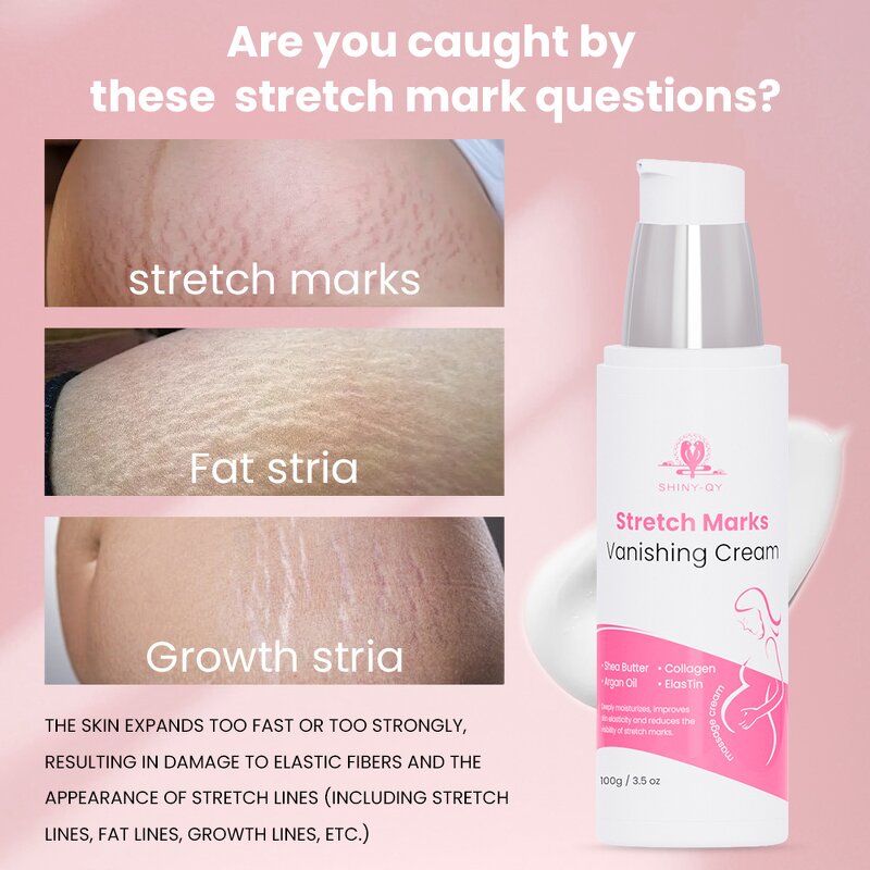 Anti-Stretch Mark Cream Manufacturer - Custom Organic Anti Stretch Mark Wrinkle Beauty Scar Removal Cream