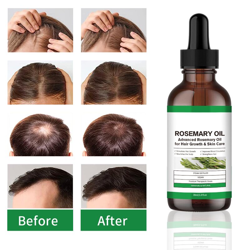 Hair Growth Oil Manufacturer - Private Label Scalp Care Anti-Hair Loss Rosemary Oil for Hair Growth