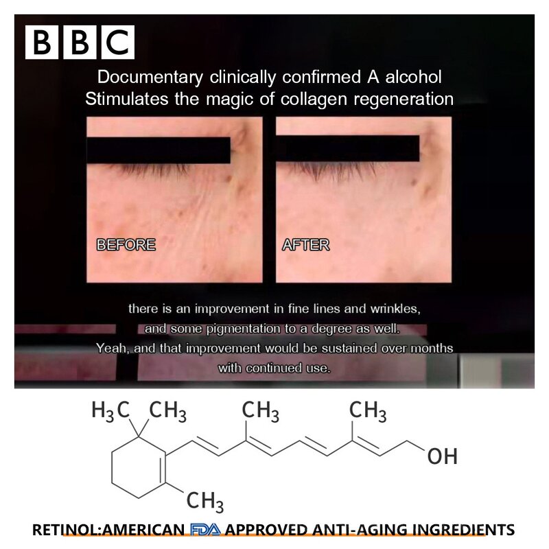 Eye Cream Manufacturer - Customized Natural Anti Wrinkle Collagen Caffeine Retinol Eye Treatment Formula