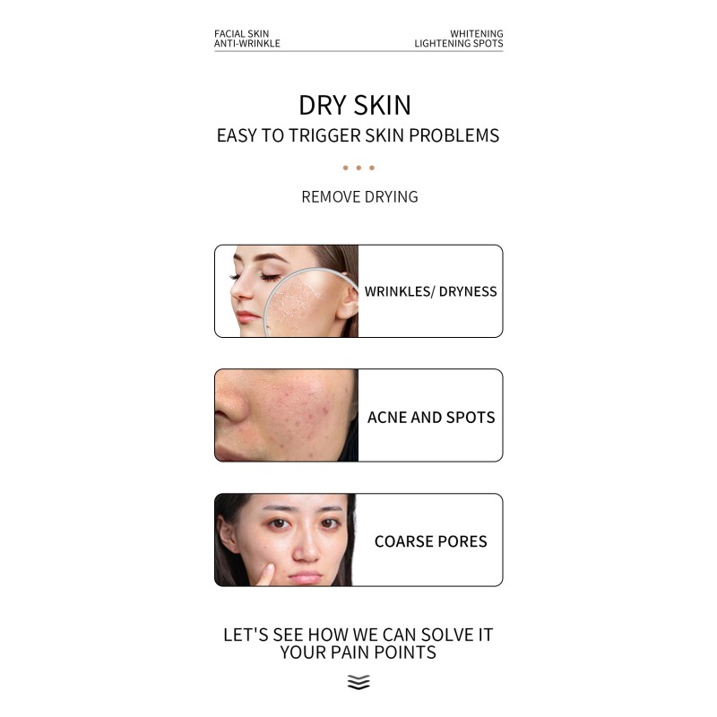 Anti-Aging Cream Supplier - Private Label Retinol Dark Spot Removal Face Lotion