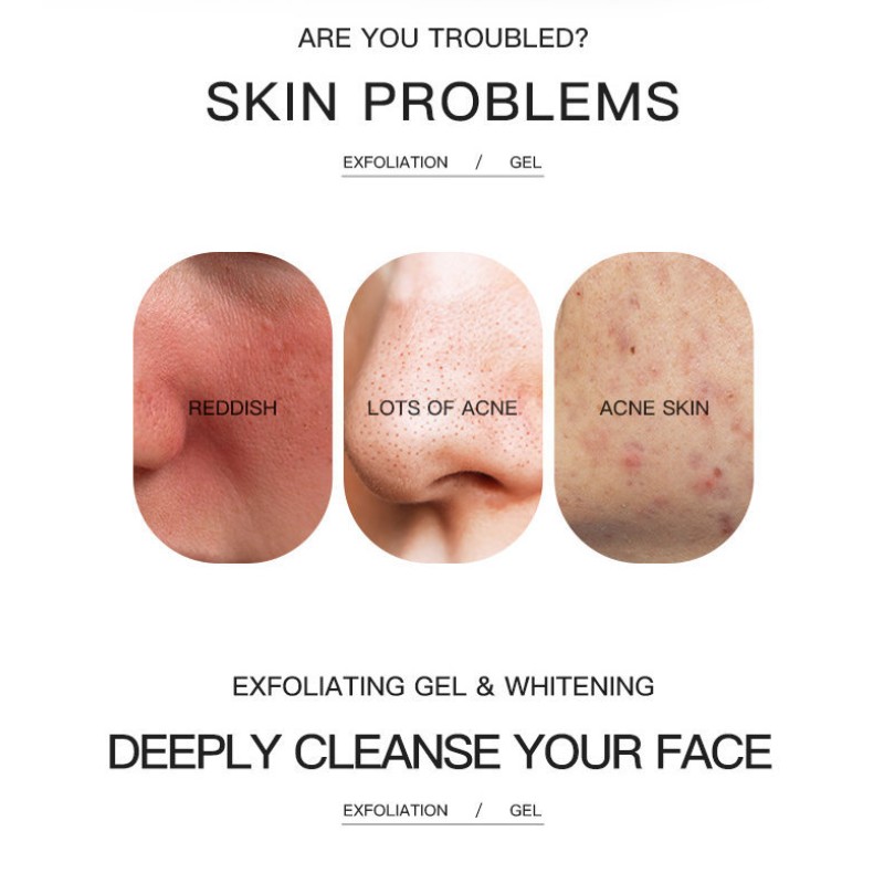 Exfoliating Gel Manufacturer - OEM Unisex Home Use Facial Effective Exfoliation Cleanser