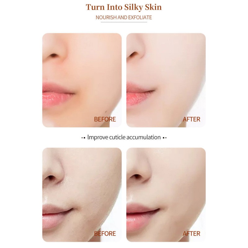 Retinol Eye Essence Factory - OEM Morning Night Whitening Anti-Aging Lifting Essence